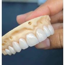 活動義齒; 固定義齒; 假牙加工; 烤瓷牙; 二氧化鋯; 貴金屬烤瓷牙