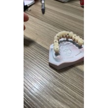 深圳義齒種植牙廠家 發貨全球 通過FDA 認證 義齒加工廠