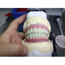 Full Denture Implants